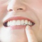 美容